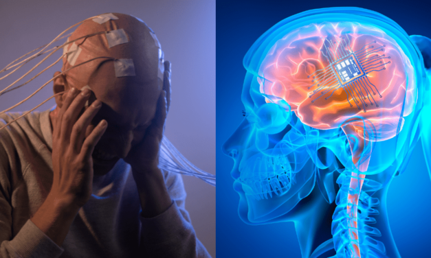 Budeme ovládať veci iba pomocou mysle? Čip implementovali prvýkrát do mozgu človeka