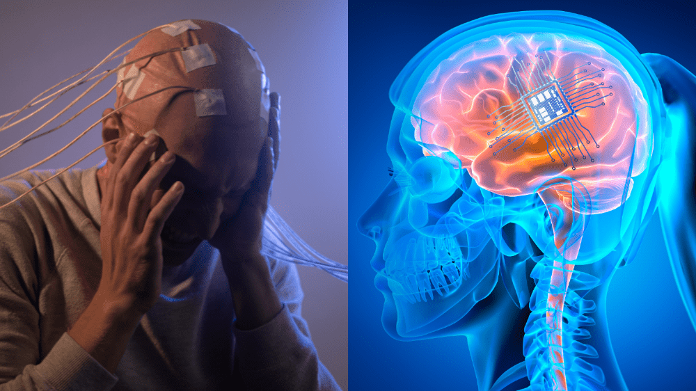 Budeme ovládať veci iba pomocou mysle? Čip implementovali prvýkrát do mozgu človeka